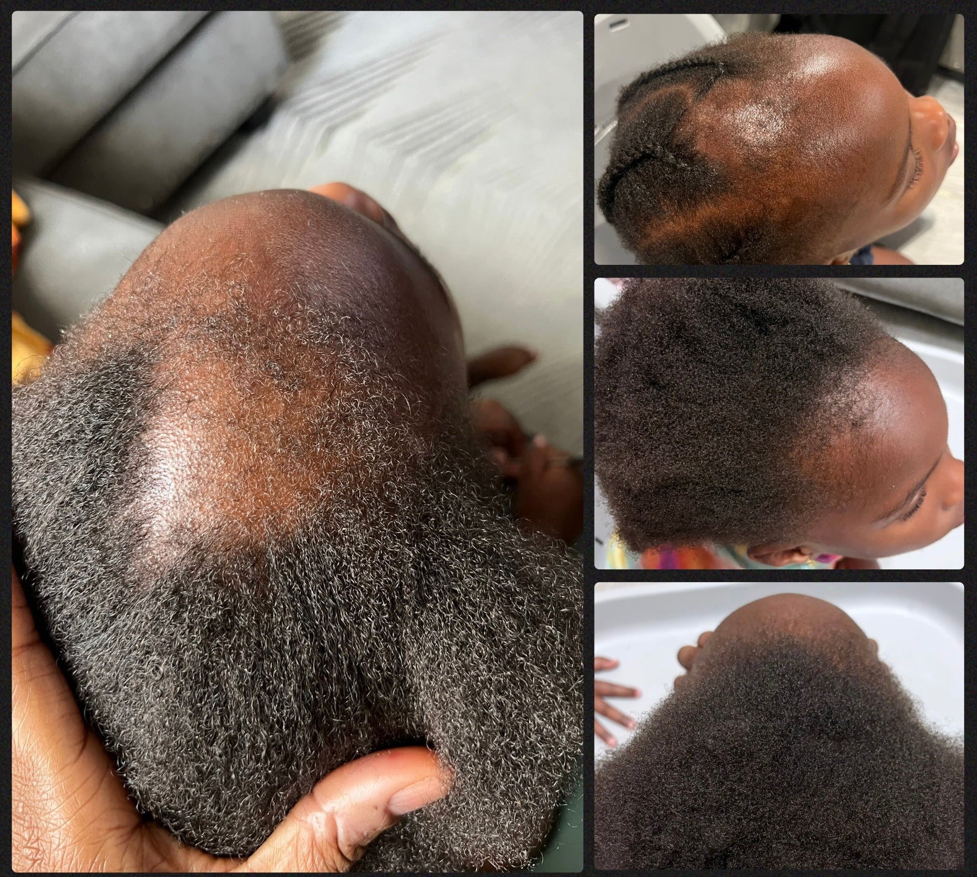Complete Hair Grow Kit