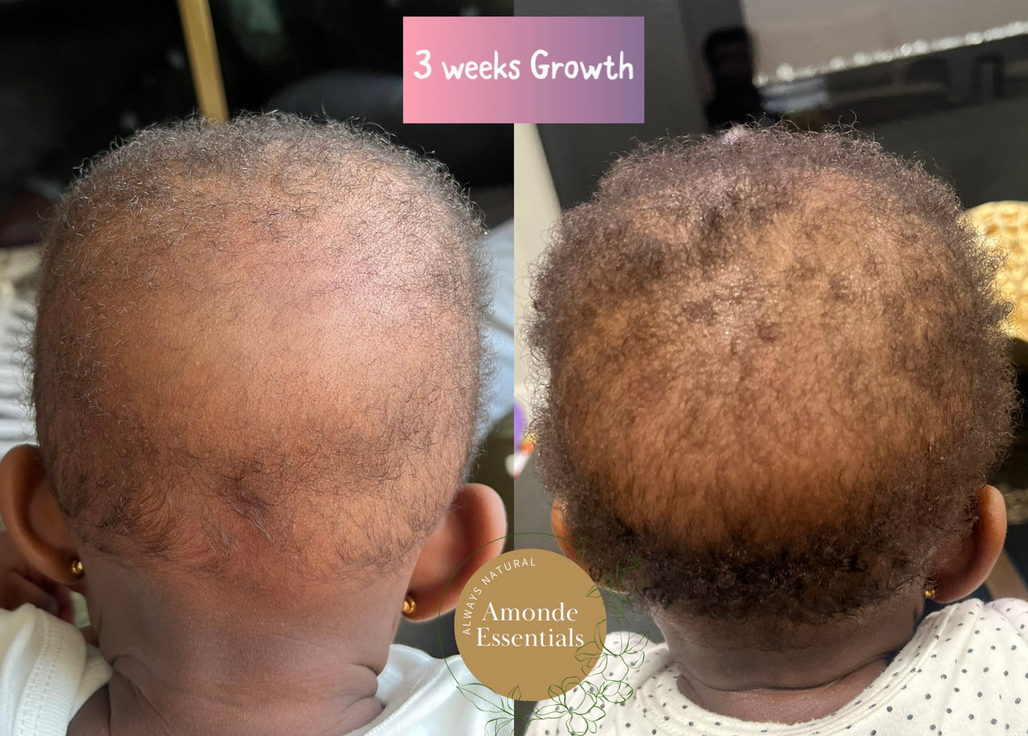 Stimulating Scalp and Hair Butter