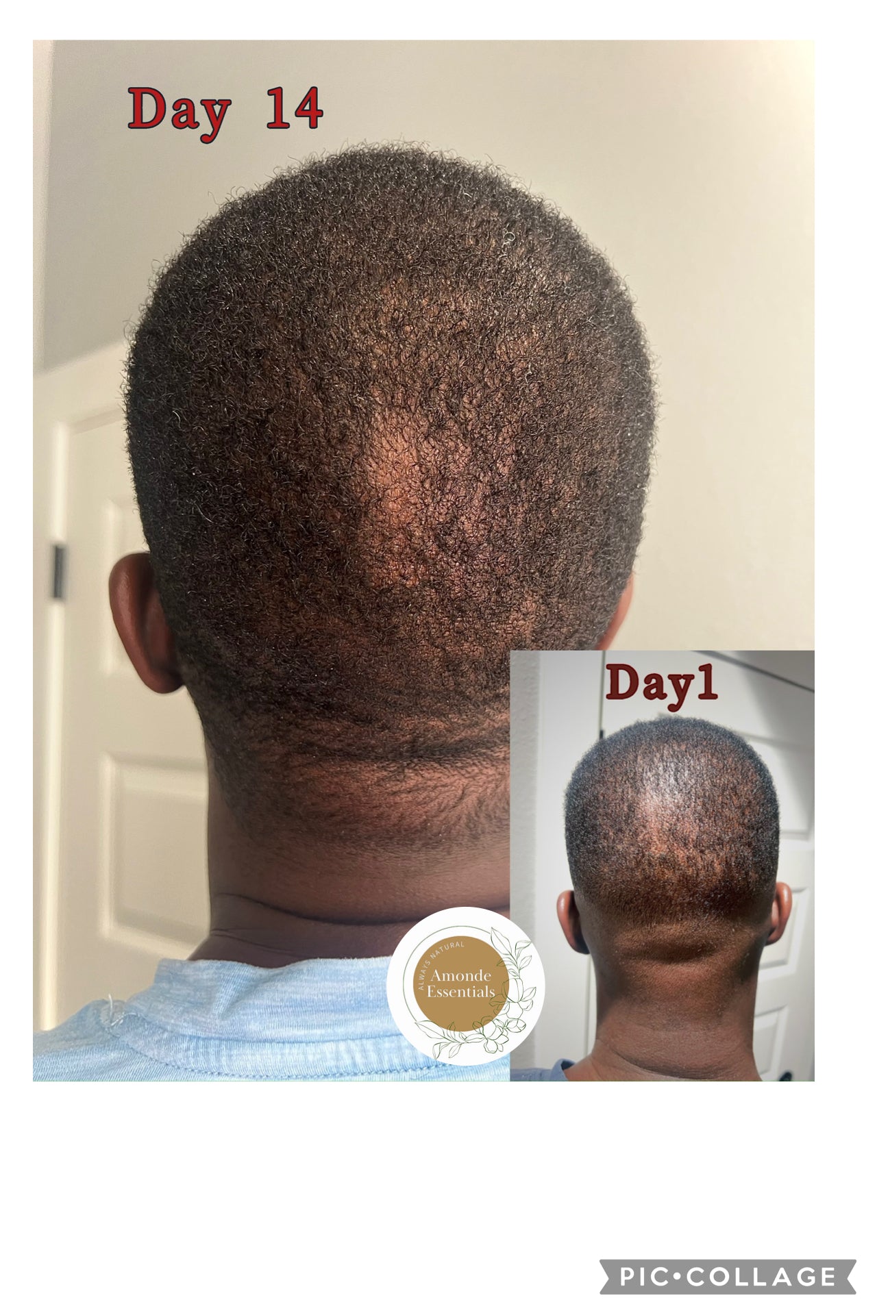 Stimulating Scalp and Hair Butter